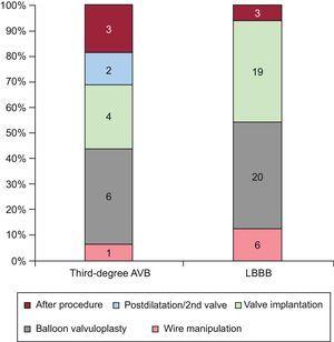 Timing of conduction abnormalities during TAVI procedure. Number of patients with new LBBB and third-degree AVB at each step of the TAVI procedure. AVB, atrioventricular block; LBBB, left bundle branch block; TAVI, transcatheter aortic valve implantation.