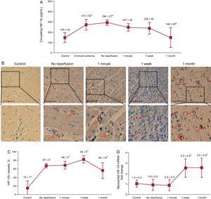 Dynamics of HIF-1A following myocardial infarction. A: the circulating levels of HIF-1A in the coronary serum at different times of the ischemia and reperfusion process. The concentration of HIF-1A in the coronary sinus was significantly elevated during ischemia and was progressively lowered during the first month after reperfusion. Data (mean ± standard deviation, n ≥ 5) were analyzed by 1-way ANOVA analysis followed by Bonferroni test. aP < .01 vs control. bP < .05 vs no reperfusion. B: immunohistochemistry analysis of HIF-1A expression in the infarcted myocardium at different times of the ischemia and reperfusion process. Representative images of the infarcted area from the control group and the 4 myocardial infarction groups (no reperfusion, 1-minute, 1-week and 1-month reperfusion) are shown. Arrows indicate HIF-1A+ vessels. The scale bars indicate 100μm. C: quantification of the presence of HIF-1A in the infarcted myocardium. Images from the infarcted area isolated from the 5 independent groups were analyzed with Image-Pro Plus analysis software. The percentage of HIF+ vessels was significantly increased in the infarcted myocardium from all AMI groups. Data (mean ± standard deviation, n ≥ 5) were analyzed by 1-way ANOVA analysis followed by Bonferroni test. Scoring was performed by a blinded observer unaware of the experimental group. *P < .01 vs control. D: expression of HIF-1A in the infarcted myocardium at different times of the ischemia and reperfusion process. HIF-1A mRNA expression was upregulated in the infarcted myocardium 1 week and 1 month after reperfusion in comparison with controls. Data (mean ± standard deviation, n ≥ 5 independent experiments performed in triplicate) were analyzed by 1-way ANOVA analysis followed by Bonferroni test. *P < .05 vs control. AMI, acute myocardial infarction; HIF-1A, hypoxia-inducible factor-1A.