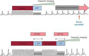 Algoritmo de funcionamiento del desfibrilador automático implantable para ATP BC y DC. Solo ATP DC (panel superior) y BC/DC (panel inferior). ATP, estimulación antitaquicardia; BC, antes de cargar; DC, durante la carga. Modificado con permiso de Schwab et al.21