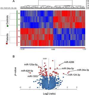 miRNA expression profile in EAT samples from 3 CHD-SCD patients and 3 non–CHD-SD controls. A: unsupervised hierarchical clustering showing different miRNAs expression patterns (red for up-regulated miRNAs, blue for down-regulated miRNAs). B: Vulcano plot representing the magnitude of the changes of those miRNAs differentially expressed (± 1.5 fold change, P < .05, shaded lines). CHD, coronary heart disease; EAT, epicardial adipose tissue; miRNA, microRNA; SCD, sudden cardiac death; SD, sudden death. Statistical significance (P < .05) was assessed by ANOVA.