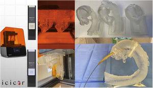 Images of the process and results of three-dimensional printing based on imaging tests performed on patients.