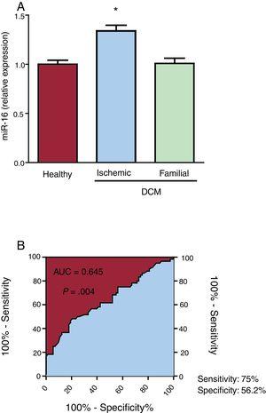 Plasma microRNA-16-5p (miR-16) expression detected by quantitative real-time polymerase chain reaction (qRT-PCR) in healthy individuals and in ischemic and familial dilated cardiomyopathy (DCM) patients. A: miR-16 expression was significantly increased in ischemic DCM patients (n=60) compared with familial DCM patients (n=32) and healthy individuals (n=76). B: receiver operating characteristic (ROC) analysis of miR-16 for ischemic DCM, with an area under curve (AUC) of 0.645 (95%CI, 0.55-0.74; P=.004), sensitivity of 75%, and specificity of 56.2%. *P <.05.