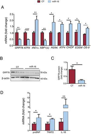 Effects of microRNA-16-5p (miR-16) on endoplasmic reticulum (ER) stress, heart failure biomarkers, and inflammation in human cardiac cells. A: relative mRNA levels of ER stress markers (GRP78, ATF6, IRE1α, XBP1(s), ATF4, CHOP, EDEM, and OS-9) were detected by quantitative real-time polymerase chain reaction (qRT-PCR) and normalized to that of GAPDH (n=5). B: whole cell lysates were subjected to immunoblot analysis with specific antibodies against GRP78 and β-actin (n=3). C: quantification of GRP78 protein levels, normalized to that of β-actin (n=3). D: relative mRNA levels of HF (pro-B-type natriuretic peptide and TNNT2) and inflammatory (IL-1B) biomarkers were detected by qRT-PCR and normalized to that of GAPDH (n=5). Results are expressed as mean±standard error of the mean. CT, control AC16 cells; miR-16, microRNA-16-5p–overexpressing AC16 cells. *P < .05, **P < .005.