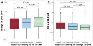 Comparative box plot charts (median and interquartile range values). A: bipolar voltage (EAM) in areas classified as healthy tissue, interstitial fibrosis, and dense scar by IIR (CMR). B: IIR values (CMR) in areas classified as healthy tissue, interstitial fibrosis, and dense scar by EAM. CMR, cardiac magnetic resonance; EAM, electroanatomical map; IIR, image intensity ratio.