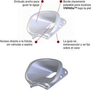 Orificios de sutura y localización del embudo de la guía VWNG.