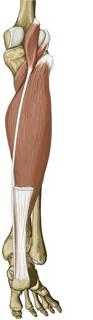 Course of plantaris tendon in calf.