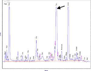 Cromatograma de la primera muestra de orina. Concentración de tirosina (flecha): fuera de escala.