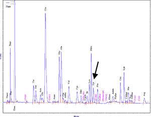 Cromatograma de la muestra de sangre. Concentración de tirosina (flecha)=108μmol/L dentro del rango de referencia.