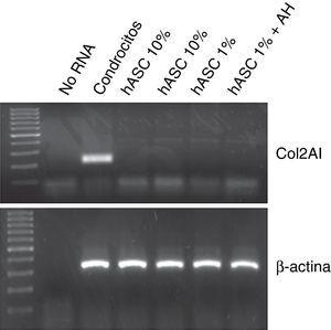 Expresión de mRNA para colágeno tipo 2 mediante RT-PCR. El fragmento específico para colágeno tipo 2 (204pb) solo se observa en condrocitos (control positivo), mientras que todas las muestras de células contenían el fragmento de ß-Actina (309pb).