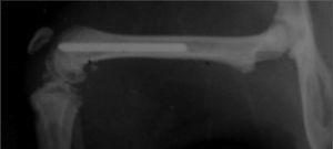 Radiografía de fémur con aguja de Ti6Al4V implantada en su interior.