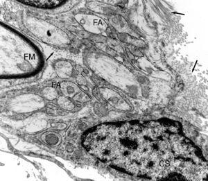 Imagen ultraestructural de una de las unidades de regeneración dentro de una prótesis de nervio isogénico acelular. Se distingue una fibra mielínica (FM) y numerosas fibras amielínicas (FA). Puede observarse una pequeña zona de una célula de Schwann (CS). En el espacio endoneural se distinguen fibras de colágeno (fechas).