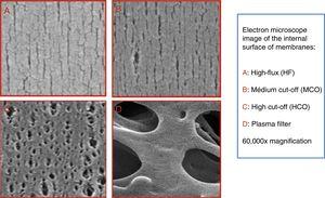 Microphotography of the inside of the four membrane types, according to the size of pores: (A) High-flux (HF); (B) medium cut-off (MCO) (Theranova®); (C) high cut-off (HCO); (D) plasma filter. 60,000× magnification.
