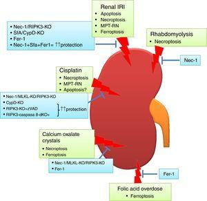 Regulated necrosis in kidney disease. Different pathways of cell death are activated and contribute to kidney injury, based on intervention studies in vivo in preclinical models of AKI. Ferroptosis and necroptosis are the forms of cell death involved in most specific etiologies of AKI. IRI: ischemia-reperfusion injury.