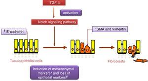 The Notch pathway regulates the epithelial–mesenchymal transition process induced by TGF-β in tubuloepithelial cells.