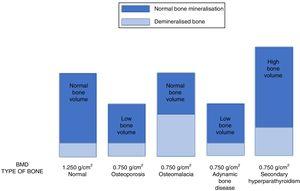 The image shows how different pathologies (senile osteoporosis or osteoporosis secondary to hypogonadism, osteomalacia, adynamic bone disease and secondary hyperparathyroidism) can show the same low bone mineral density (in this example, BMD=0.750g/cm2) although they are caused by a completely different bone composition, and require different treatment strategies.112,133