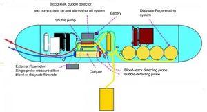 Diagram of WAK. Color code – Red: blood from patient; Blue: blood to patient; Yellow: dialysate to ultrafiltrate.