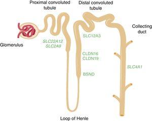 Diagram of the nephron showing the segments of the tubule where the genes mentioned in the text are expressed. The SLC22A12 and SLC2A9 genes which encode the uric acid transporters URAT1 and GLUT9, respectively, are expressed in the proximal tubule. The CLDN16 and CLDN19 genes which encode claudin-16 and claudin-19 respectively are expressed in the tight junction areas of the thick ascending limb of the loop of Henle. The BSND gene which encodes barttin is expressed in that same segment of the tubule, but also in the stria vascularis cells in the inner ear. The SLC12A3 gene which encodes the thiazide-sensitive NaCl co-transporter is expressed in the cells of the distal convoluted tubule. The SLC4A1 gene encodes the isoforms of anion exchanger 1 (AE1) in erythrocytes and kidney. In the last case, the protein is located in the renal collecting duct.