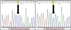 DNA sequence electropherograms of rs1801282 polymorphism in the PPARγ gene. Examples of homozygous dominant (JJ genotype) and homozygous recessive (jj genotype) condition of the studied SNP.