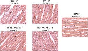 Representative images of hematoxylin-eosin staining of cardiomyocytes in each group (40× magnification). CRF + NP (group 1), 7/8 nephrectomy on a normal phosphorous diet; CRF + HP (group 2), 7/8 nephrectomy on a high phosphorus diet; CRF + PTx + rPTH + HP (group 3), 7/8 nephrectomy with parathyroidectomy, PTH replacement on a high phosphorus diet; CRF + PTx + rPTH + NP (group 4), 7/8 nephrectomy with parathyroidectomy and on a normal phosphorous diet; SHAM (group 5), sham intervention for nephrectomy and parathyroidectomy.