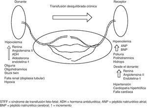 Cambios fisiopatológicos del STFF. ↑: incremento; ADH: hormona antidiurética; ANP: péptido natriurético atrial; BNP: péptido natriurético cerebral; STFF: síndrome de transfusión feto-fetal.