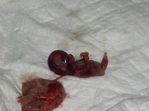 Fotografía fetal del caso 2, espécimen con sirenomelia.