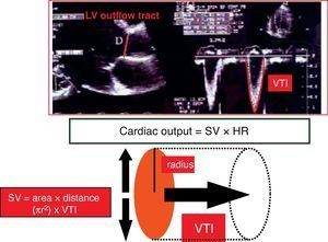 Estimating Cardiac Output Utility In The Clinical Practice Available Invasive And Non Invasive Monitoring Medicina Intensiva