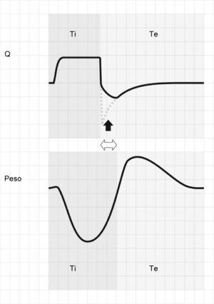 Tracing corresponding to Q (top) and Peso (bottom) with respiration under conventional mechanical ventilation without inspiratory pause. Tivent is seen to end before Tipac (double hollow arrow), causing amputation of the peak expiratory flow (solid arrow). The broken tracing, placed as reference, represents the behavior which Q would have had in the absence of overlaid patient inspiratory effort.