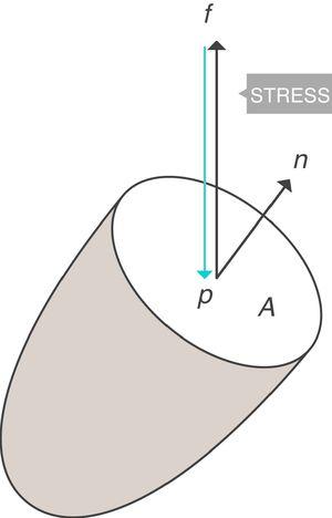 Stress=pressure. Source: Reproduced with permission Modesto-Alapont et al.5