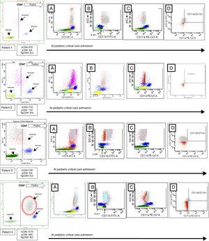 Flow cytometry analysis of patients with Bordetella pertussis infection. The granulocytes, monocytes, and lymphocytes were identified on dot-plot profile and gated by its CD64 expression. The positive CD64 region is marked by a discontinued line. In patient 4 the positive CD64 granulocytes are rounded by a discontinued circle. In each patient, and from left to right, the CD18 expression is showed in the A dot-plot, the CD11b expression is showed in the B dot-plot, CD11a expression is showed in the C dot-plot and granulocytes CD11b+/CD11a+ are showed in the D dot-plot. mCD64: mean fluorescence intensity or MFI of CD64 in monocytes; gCD64: MFI of CD64 in granulocytes; gCD64+: percentage of positive CD64 granulocytes.