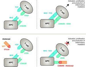 Mécanisme d'action de l'abatacept. Le fragment d'abatacept comprenant le domaine extracellulaire de CTLA4 se lie aux récepteurs CD80/CD86, empêchant ou déplaçant son interaction avec le récepteur CD28. De cette façon, il bloque sélectivement la liaison spécifique de CD80/CD86 au récepteur CD28, ce qui constitue, sur le plan physiopathologique, un blocage du second signal d'activation immunitaire et, par conséquent, de l'activation des cellules T CPA, cellule présentatrice d'antigène ; CMH, complexe majeur d'histocompatibilité ; TCR, récepteur des cellules T.