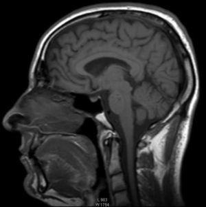 Brain MRI.