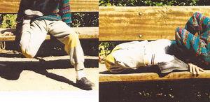 Joint hypermobility of the lower limbs at 10 years of age.