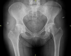 Radiograph of the hip.