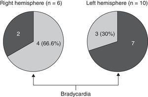 Bradycardia in patients with FTD and no bradycardic drugs and an MRI scan indicating highly lateralised atrophy.