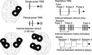 Schematic representation of the different types of TMS: single-pulse TMS, paired-pulse TMS of one or 2 different brain regions, and repetitive TMS (low-frequency: ≤1Hz; high-frequency: ≥5Hz). ®: response. Adapted with permission from Pascual-Leone et al.15
