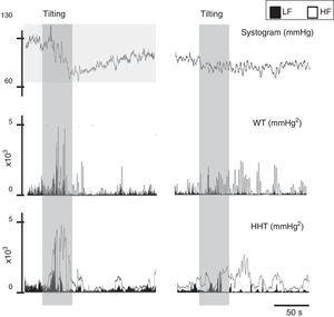 Signal processing of biological signals. Left: data from a normal subject; right: data from a patient with paroxysmal atrial fibrillation. The same signal, the systogram obtained from systolic blood pressure, has been treated with wavelets (Db12) and the Hilbert-Huang transform. The differences in the autonomic output of the two individuals can be clearly distinguished. Note that this example is merely illustrative, as the tachogram obtained from the RR interval for both patients is not shown. HF: high frequency; HHT: Hilbert-Huang transform; LF: low frequency; WT: wavelets.