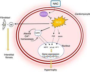 Role of oxidative stress in the pathophysiology of hypertrophic cardiomyopathy and mechanism of action of N-acetylcysteine.14,34 AP-1: activator protein; CaMKII: Ca2+/calmodulin-dependent protein kinase II; MAPK: mitogen-activated protein kinase; NAC: N-acetylcysteine; NF-κB: nuclear factor kappa B; PKB: protein kinase B; ROS: reactive oxygen species.
