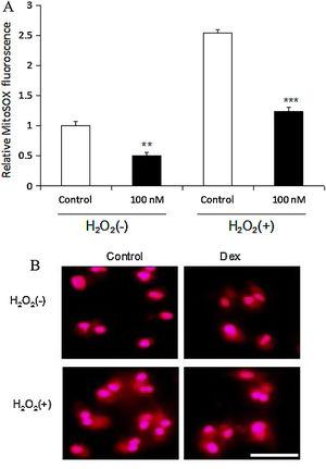 Dexmedetomidine decreases sensitivity of ROS response to H2O2 in cardiomyocytes. (A) Relative MitoSOX fluorescence of cardiomyocytes treated by dexmedetomidine with or without H2O2 (n=8 per group); (B) representative MitoSOX fluorescence images of cardiomyocytes with or without H2O2 stimulation following dexmedetomidine pretreatment (scale bar=50 μm). Statistical significance was determined using one-way analysis of variance (**p<0.01, ***p<0.001, 100 nM vs. control, n=10 per group). 100 nM group: cardiomyocytes treated with dexmedetomidine; Dex: dexmedetomidine; H2O2: hydrogen peroxide; ROS: reactive oxygen species.
