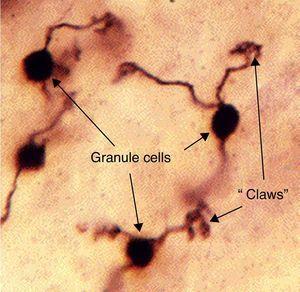 Modelo histológico de la célula granulosa y su unión a fibras musgosas. Fuente: Medicine TWUSo25.