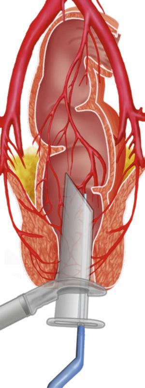 Identification of arterioles.
