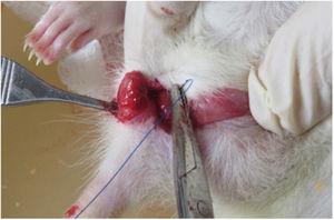 U-suture sphincteroplasty.