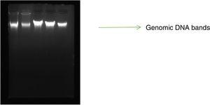 Qualitative analysis of DNA extraction Via Agarose gel electrophoresis. Sample of DNA extracted in 1.5% agarose gel electrophoresis. The bands of extracted DNA are noticeable.