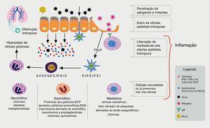 Processo imune envolvido na resposta aos vírus respiratórios e relação com a inflamação alérgica. Os vírus respiratórios infectam as células epiteliais brônquicas (bronchial epithelial cells, BECs) através de receptores (tool‐like receptors, TLRs). Durante a replicação desencadeiam processo inflamatório com indução da produção de citocinas e quimiocinas pela BECs, dentre elas o INF‐1, TNFα, IL33, IL 25 e linfopoetina tímica estromal (thymic stromal lymphopoietin, TSLP). As células dendríticas (dendritic cells, DC), componentes da imunidade inata, após capturarem os antígenos virais dirigem‐se aos órgãos linfoides secundários, e lá estimulam as células linfoides, protagonistas da resposta imune específica. Nos asmáticos, a produção de IFNs é reduzida, o que permite maior replicação viral e, com o estímulo da TSLP, ocorre um desvio do perfil linfoide para linfócitos tipo 2 (Th2), promovendo menor resposta antiviral e maior inflamação alérgica, com hiper‐reatividade brônquica e aumento na produção de muco, acarretando obstrução brônquica e exacerbação da asma.