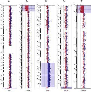 Perfis de taxa de CGH‐array dos cromossomos em quatro neonatos com desequilíbrios cromossômicos patogênicos usando DNA genômico dos neonatos como teste (em vermelho) e DNA de indivíduos normais como referência (em azul). São apresentados os dados das razões de teste/referência de cada cromossomo. Cada ponto representa uma única sonda (oligo) encontrada no array. A razão de log das sondas cromossômicas está traçada como uma função da posição cromossômica. A perda de número de cópias move a razão para a esquerda (valor de cerca de ‐1x). O ganho de número de cópias move a razão para a direita (valor de cerca de+1x). O ideograma de cada cromossomo (margem esquerda) mostra a localização de cada sonda. As razões de log2da sonda foram traçadas de acordo com as coordenadas genômicas (com base no UCSC Genome Browser, fevereiro de 2009, sequência de referência NCBI Build 37). A: A ∼ deleção terminal de 1,5 Mb no cromossomo 1q44 (linha azul) no caso 31. B: A ∼ deleção terminal de 12,9 Mb no cromossomo 4p16.3‐p15.33 (caixa azul) no caso 1. C: A ∼ duplicação intersticial de 49,7 Mb no cromossomo 6q22.31‐q37 (caixa azul) no caso 31. D: A ∼ deleção terminal de 2,37 Mb no cromossomo 10q26.3 (caixa azul) no caso 48. E: A ∼ deleção terminal de 7,2 Mb no cromossomo 17p13.3‐p13.1 (caixa azul) no caso 14.
