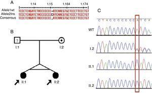 Identificação, linhagem da família dois e resultados de sequenciamento para mutação c.1149_1155insC. A) Identificação da mutação c.1149_1155insC com o software MultAlin. B) A linhagem mostra os estados afetados, identificadores individuais e genótipos em c.1149‐1155insC. A seta indica os probandos e o indivíduo com “?” tem situação do genótipo incerta. C) Cromatogramas de sequenciamento de DNA direto de membros da família em que os dois irmãos afetados têm inserção homozigótica de um C e a mãe tem um traço heterozigótico, conforme marcado pela caixa vermelha. WT, alelo selvagem.