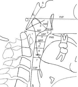 Dimensões das vias aéreas. Nasofaringe: 1. ad1‐Ba Distância de (ad1) a basion (Ba); Ad1 é o ponto de interseção da parede posterior da faringe e a linha da espinha nasal posterior (ENP) até basion (Ba); 2. ad2‐So Distância de (ad2) a (So). Ad2 é o ponto de interseção da parede posterior da faringe e da linha do ponto médio (SD) da linha da sela (S) até basion (Ba) até a espinha nasal posterior (ENP); 3. PtV‐Ad Distância do ponto (PtV) até adenoide (Ad). PtV é uma linha vertical perpendicular ao FhP que passa pelo ponto mais posterior da fossa pterigomaxilar. O ponto PtV está localizado 5mm acima da ENP. Orofaringe: 4. USP Distância de um ponto do palato mole (5mm acima do ponto superior do palato mole) (USP) até o contraponto horizontal na parede posterior da faringe até o Plano Frankfurt (FhP). 5. MPP Distância dos pontos de interseção na parede anterior e posterior da faringe do meio de (USP) e (IT) paralelos ao FhP 6. IT Distância do ponto posterior e inferior da amigdala (T) (5mm acima do ponto inferior da amigdala) até o contraponto horizontal na parede posterior da faringe paralelo ao FhP. 7. MPP Distância dos pontos de interseção na parede anterior e posterior da faringe do plano mandibular (PM), paralela ao FhP; Hipofaringe: 8. C3P Distância entre a faringe posterior, do ponto mais anterior e inferior no corpo da terceira vértebra cervical (C3) e faringe anterior.