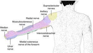 Ultrasound and nerve stimulation-guided axillary block | Colombian ...