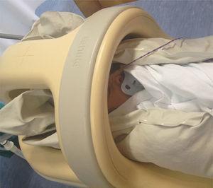 Newborn in the neonatal magnetic resonance scanner, swaddled in sheets and immobilised by the vacuum mattress.