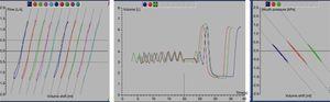 determinação do volume pulmonar por pletismografia. Representação gráfica dos resultados (Plethysmography Jaeger, Care Fusion).