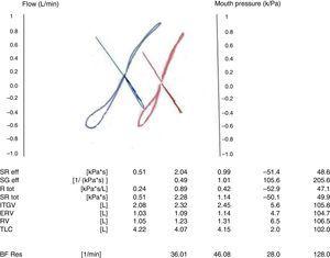 Determination of lung resistances and volumes by means of plethysmography. Positive post-bronchodilator test: decreased specific resistance (−51%) and increased specific conductance (+105%).